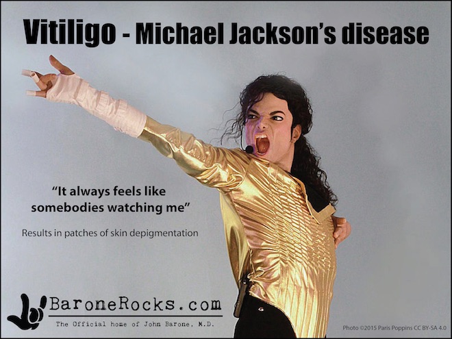 Vitiligo8