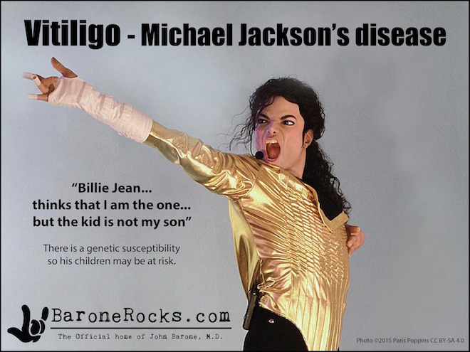 Vitiligo7